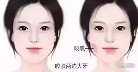 大饼脸是什么意思？一个人脸大的原因 大饼脸的瘦脸方法(图3)